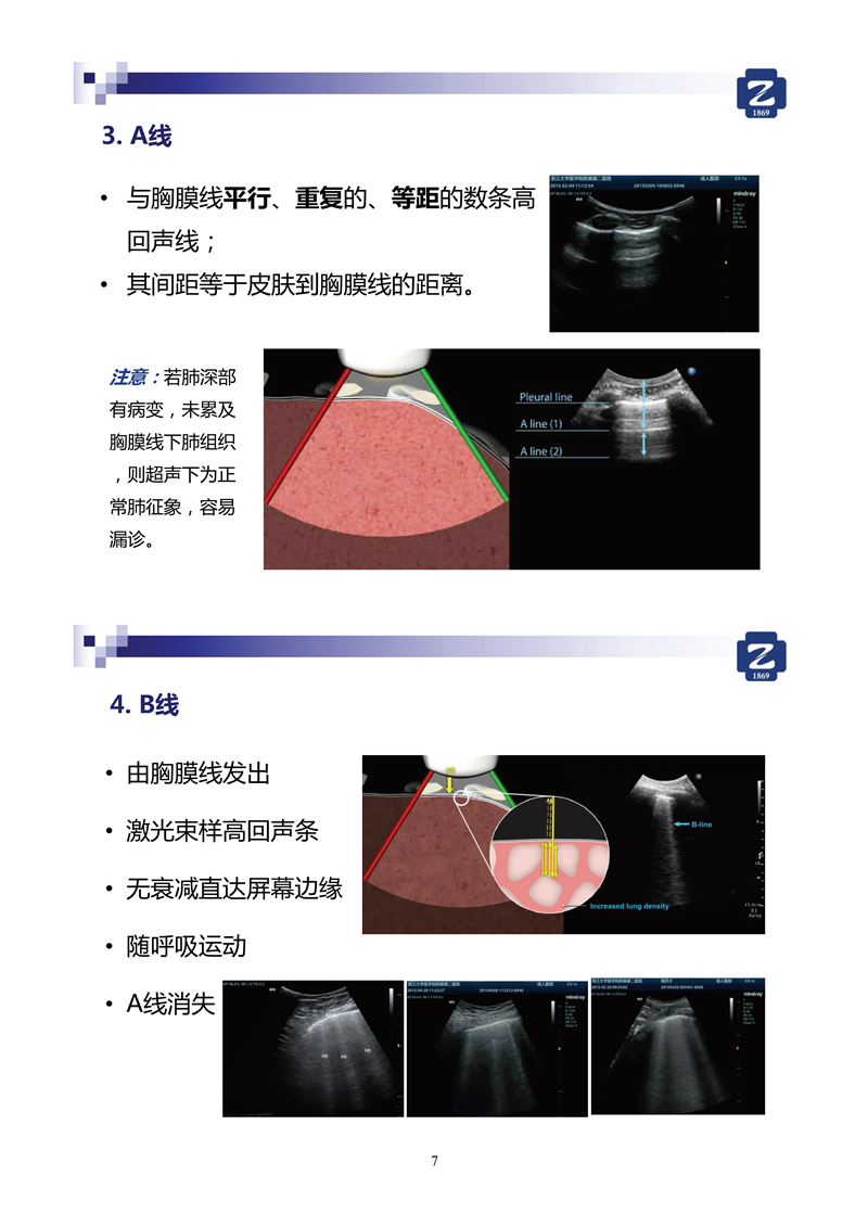 新冠肺超聲實(shí)用手冊(cè)(2)_35.jpg